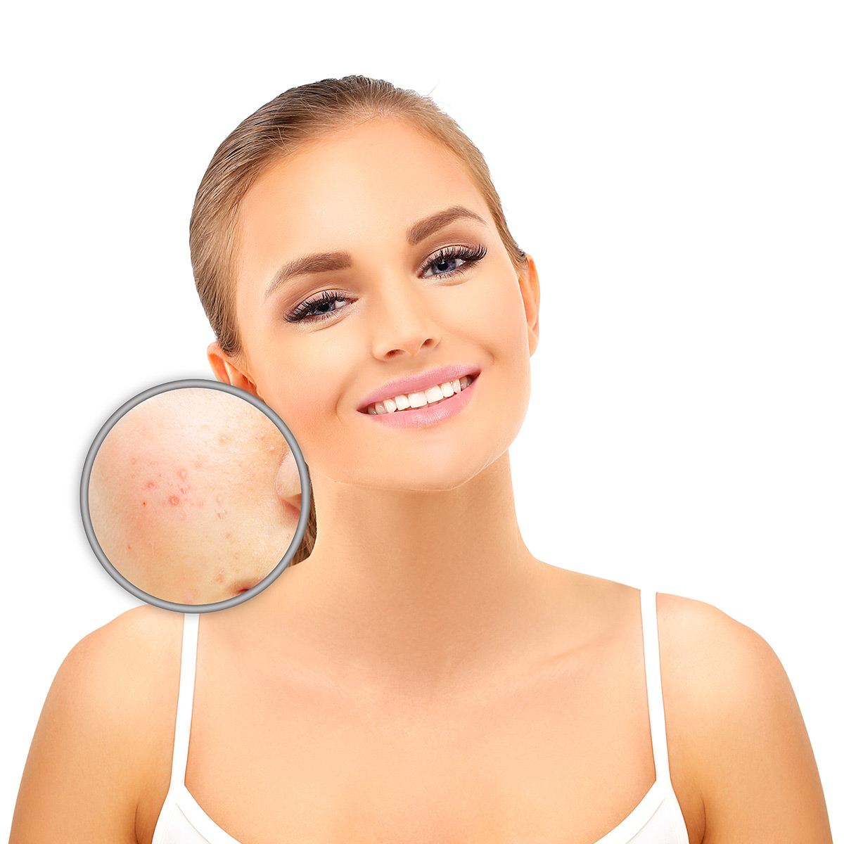 Chirurgie Cutanée